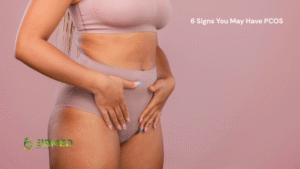 6 Signs You May Have PCOS